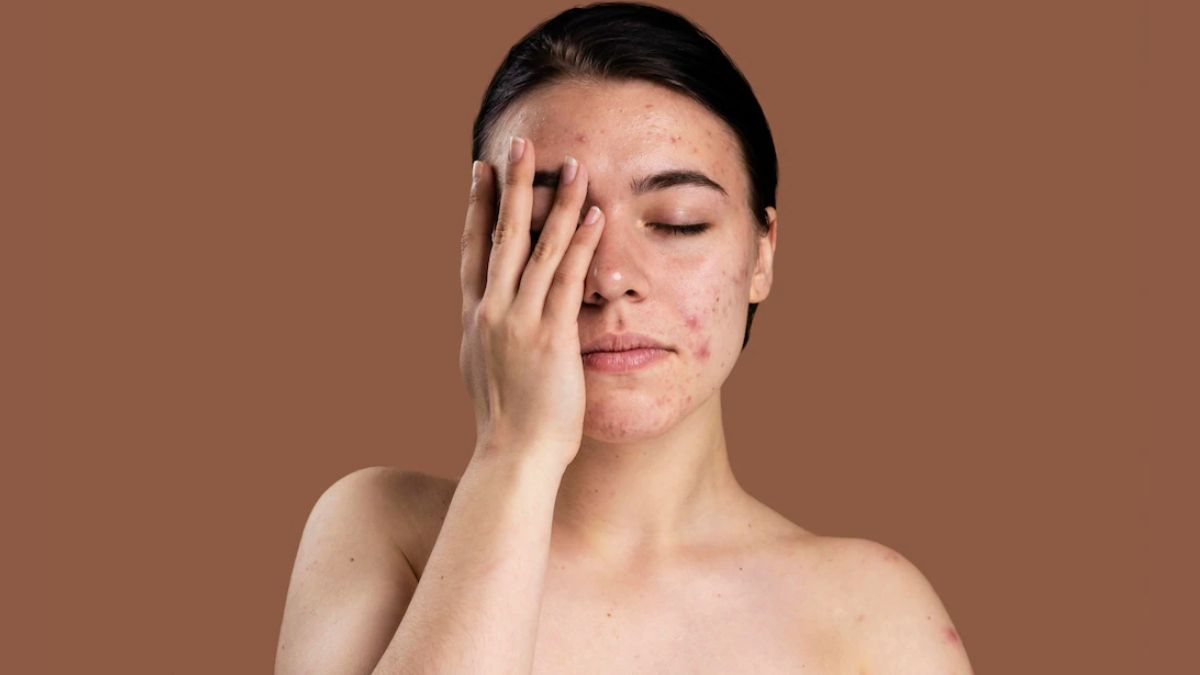 How to Shield Your Skin from the Harmful Effects of Pollution