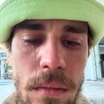 Fans Reacts As Justin Bieber Shares Photos with Teary Countenance