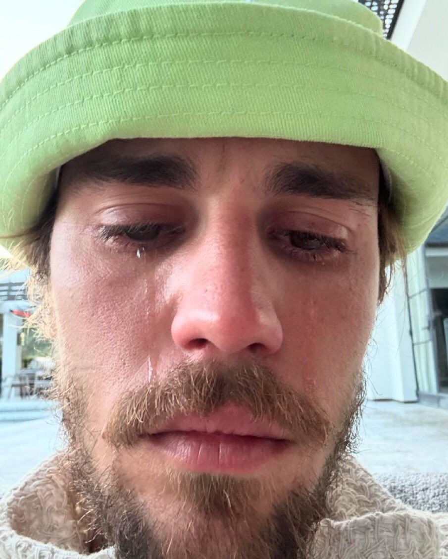 Fans Reacts As Justin Bieber Shares Photos with Teary Countenance